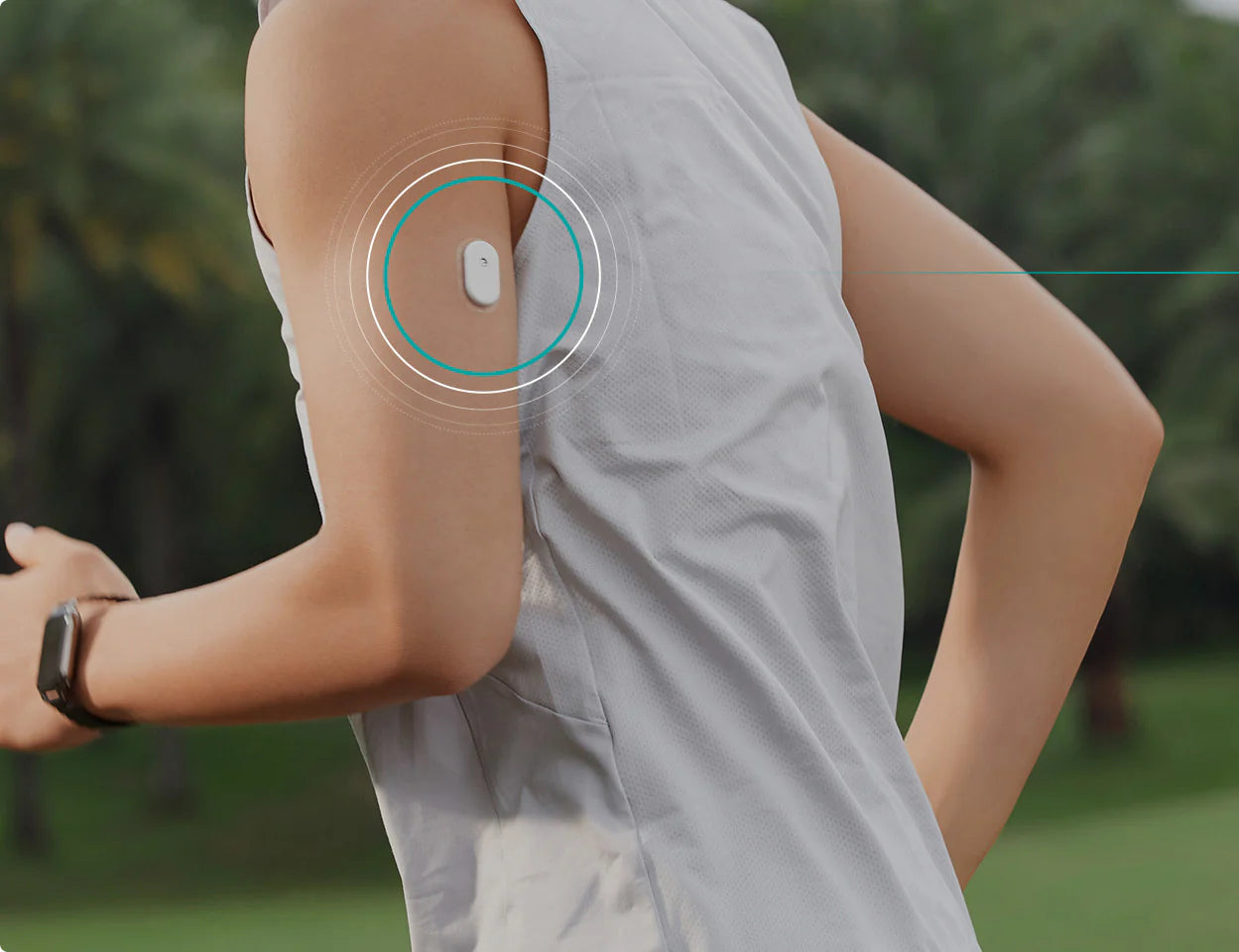 SIBIONICS GS3 – Système de surveillance continue du glucose (CGM)